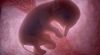 uterus